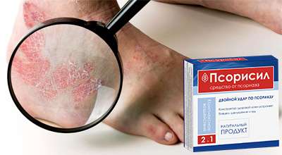 psorisil-ot-psoriaza