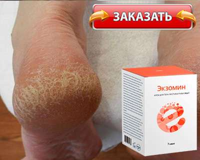 Заказать Экзомин на официальном сайте