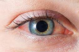 Препарат Perfect Vision способен остановить любую глазную патологию и вылечить её.