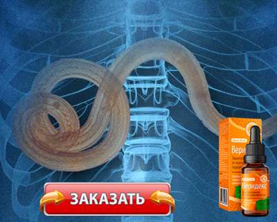 Заказать Веридекс на официальном сайте.